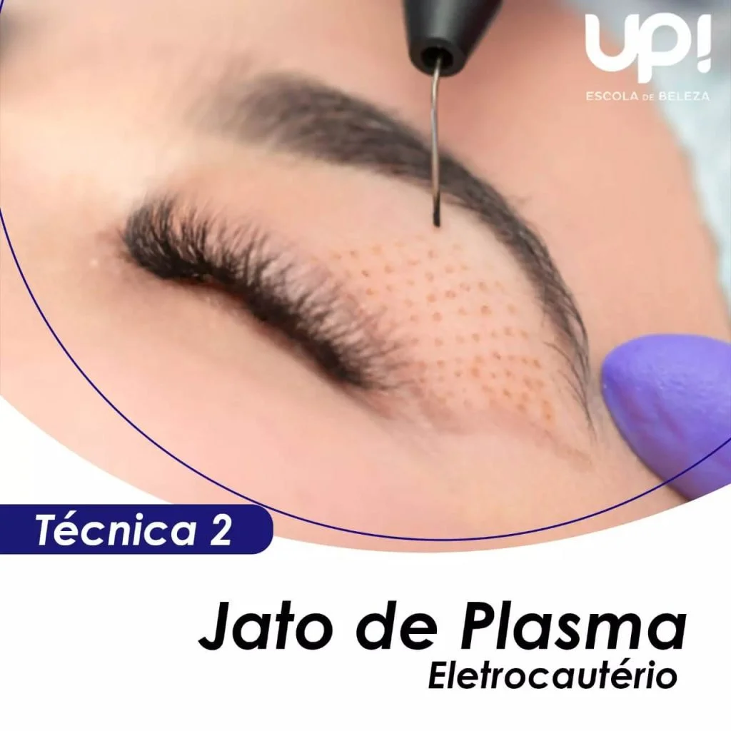 jato de plasma - UP embelezamento estético